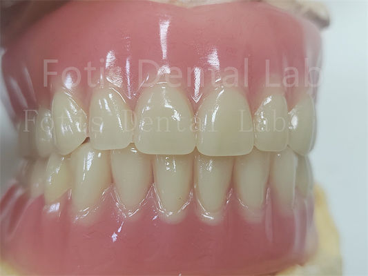 Comfort Custom Fit Protesi dentale acrilica completa per protesi dentali precise
