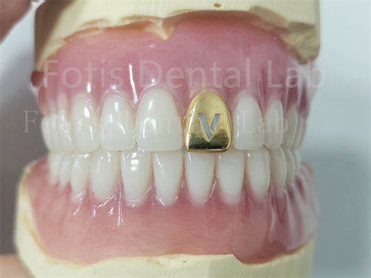 Prontezza di denti acrilici con denti naturali
