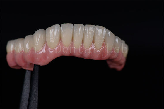 Alto tasso di successo tutti su quattro tutti su sei Impianti dentali in titanio circonia personalizzati