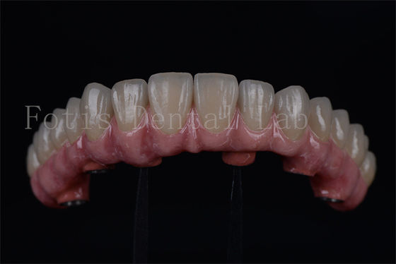Titanio / Zirconia duraturo tutto su 4 tutto su 6 recupero rapido 1-2 settimane