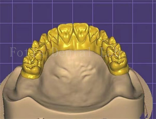 Personalizzazione Progettazione dentale innovativa per una maggiore produttività e redditività