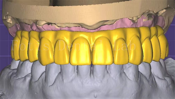Professionale 3forma crown design eccellenti prestazioni e durata
