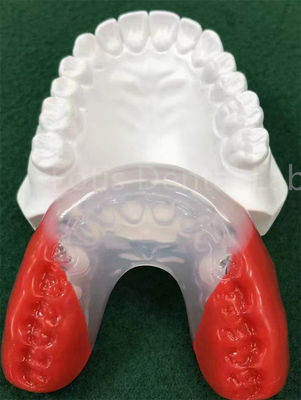 Pareti ortodontiche di grado medico per un allineamento dei denti perfetto