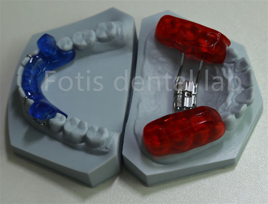 Ritenzione efficace dei denti Laboratorio odontoiatrico Ortodontico Spaziatore per l'espansione dei denti