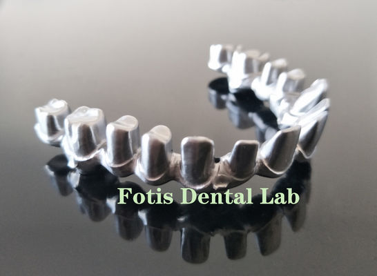 comprare Impianti dentali affidabili a arco pieno con 4 impianti dentali con ciconia in titanio online manufacture