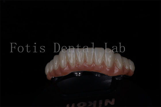 comprare Ripristino della bocca completa tutto su 4 e tutto su 6 Titanio o Zirconia online manufacture
