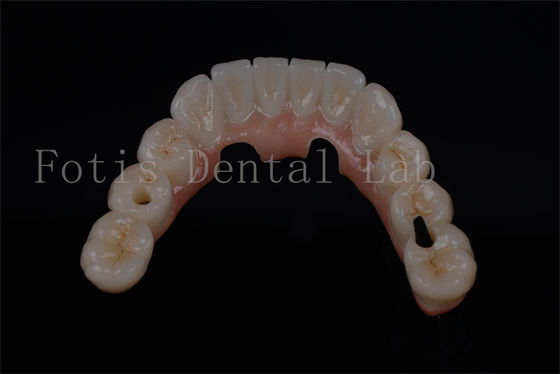 comprare Naturalmente apparire tutti su quattro denti in un giorno per qualsiasi età disponibile online manufacture