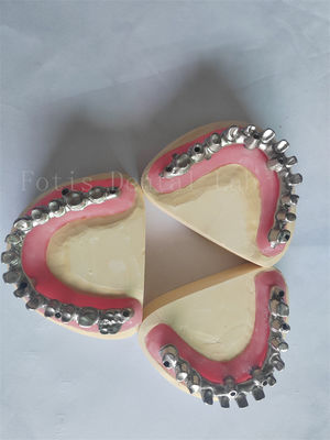comprare All On 4 All On 6 La soluzione perfetta per il restauro degli impianti dentali online manufacture