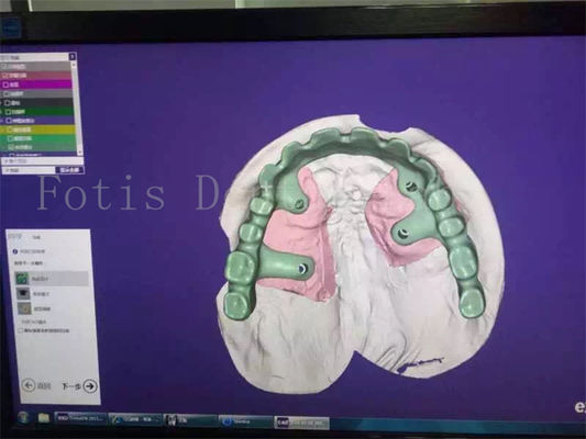 comprare Studio di progettazione di protesi dentarie per il restauro dei denti, esperto per la vostra soddisfazione online manufacture