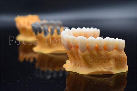 comprare Rapido Full Ziconia Design Digital Crowns 3 Shape / Exo Design Fabbricazione Lo stesso giorno online manufacture