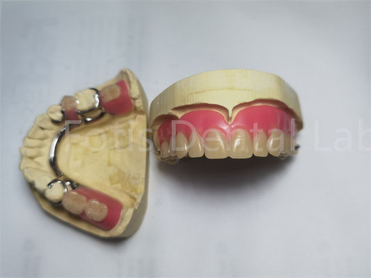 comprare Prothesi dentale rimovibile personalizzata online manufacture