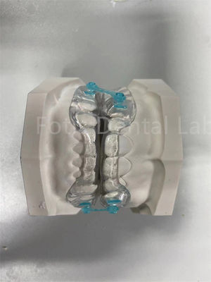comprare Dispositivo di correzione ortodontica per mantenere l'idoneità confortevole professionale online manufacture