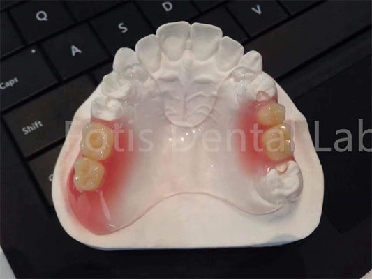 comprare Flessibile TCS Valplast Apparecchi dentali Confortevole Design durevole online manufacture