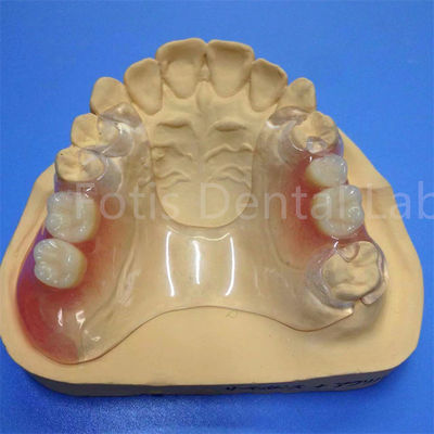 comprare Facile da pulire e regolare Protesi dentale parziale Durable Comodo online manufacture