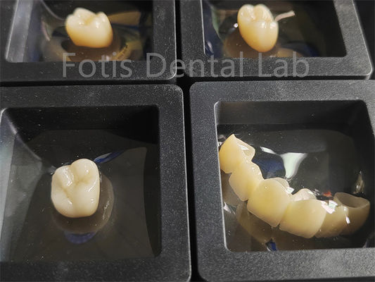 comprare Restaurazioni dentali Zirconia resistenza alle fratture online manufacture