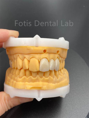 comprare Ceramica dentale in zirconia a più strati ad alta durata per prodotti medici di laboratorio dentale online manufacture