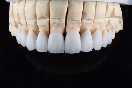 comprare Resistenza alle crepe Zirconia Multilayer Ceramica Soluzione definitiva per l'efficienza industriale online manufacture