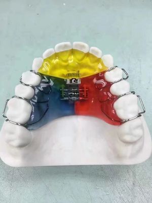 Nance / Hyrax / Rapid Palatal Expander Night Guard Space Keeper OEM sicuro da usare