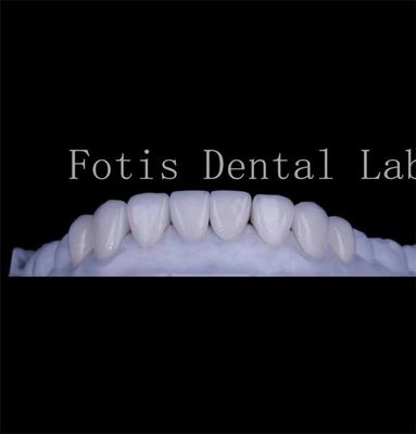 Durabile texture liscia denti copertura finiture finiture dentali naturali