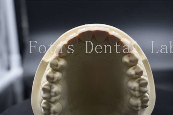 Finiture per denti artificiali di alta resistenza Finiture per denti dentistiche di porcellana di aspetto naturale