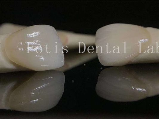 Finestre laminate di laboratorio dentale di lunga durata, personalizzabili per vari preparati dentali