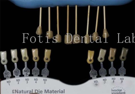 Durabile 0,3-0,5 mm di spessore finiture di laboratorio dentale finiture finte per denti