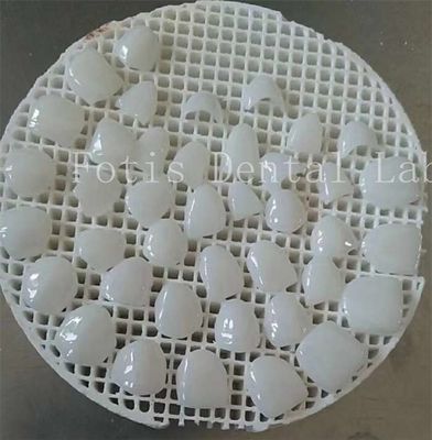 Migliora il tuo gioco di lucidatura con tessitura superficiale liscia copri denti cosmetici