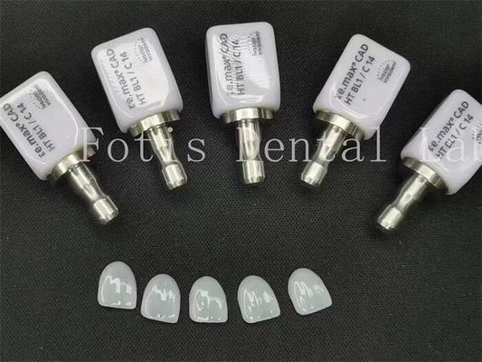 Carpetti dentali artificiali ad alta traslucidità ideali per la bella odontoiatria cosmetica