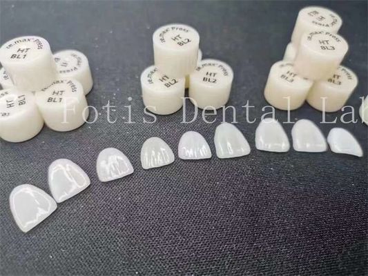 Fabricazione di rivestimenti di laboratorio dentale laminati con elevata resistenza alle macchie e resistenza