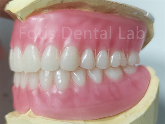 OEM Dentiera acrilica completa superiore e inferiore Resistenza alle macchie Colore naturale