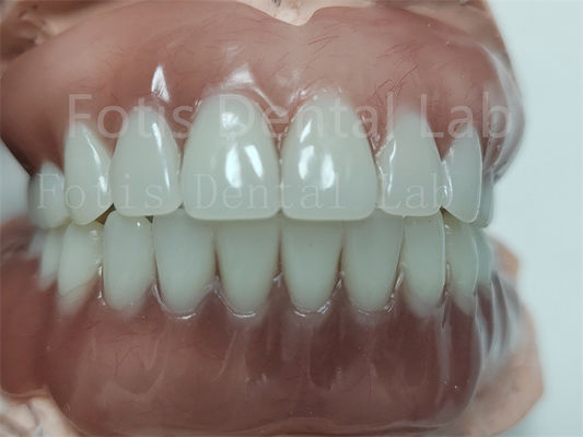 Confortevole protesi dentale acrilica completa superiore protesi dentale acrilica completa con denti ivoclari