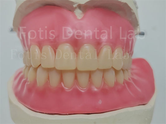 Dentiera di acrilico completo su misura a prezzi accessibili con denti Ivoclar facili da usare