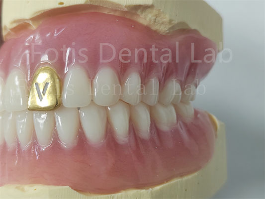 Denti di acrilico a protesi personalizzabili Denti resistenti agli odori Comfort Fit