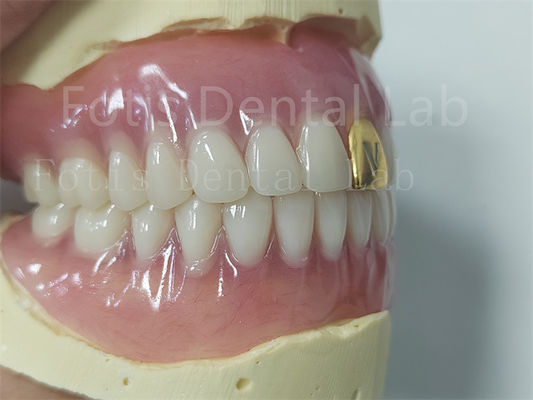 Estetica Completo Set di protesi acriliche Personalizzabile Adattabile Facile da pulire