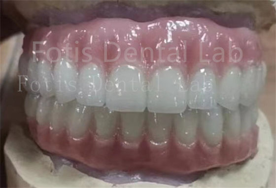 Precise Fit Ivoclar denti Acrilico protesi complete resistente alle macchie