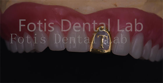OEM Dentiera naturale piena acrilica Ivoclar Denti resistenti alle macchie