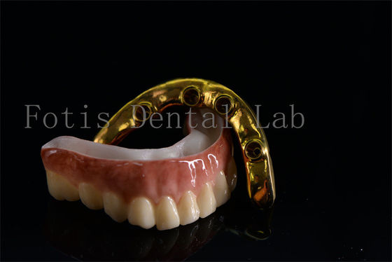 A prezzi accessibili Impianti dentali all'interno di una sola struttura Trattamenti efficaci Facile da pulire