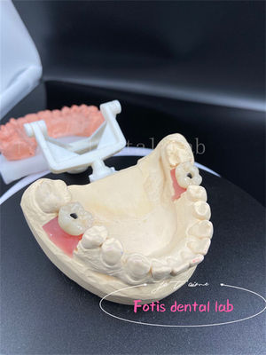 Corone dentali a forma di bocca completa di precisione facile collocazione corone dentali false