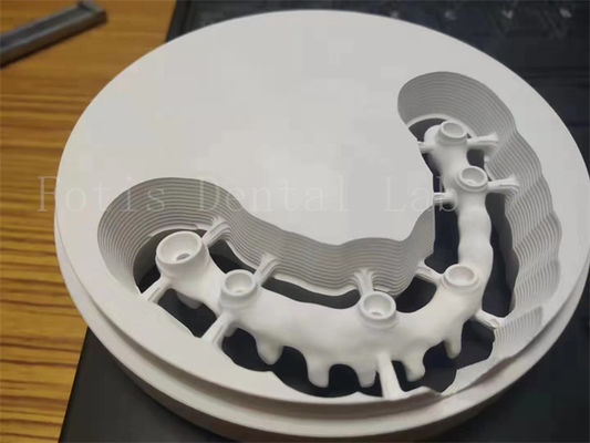 Impianto dentale lucidato igienico corona di zirconia disegno personalizzabile