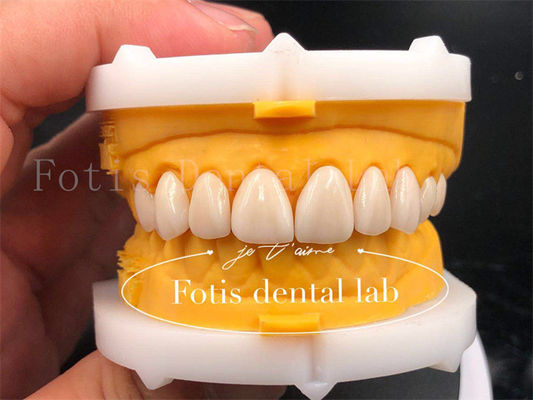 Corone dentali digitali veloci ed efficienti