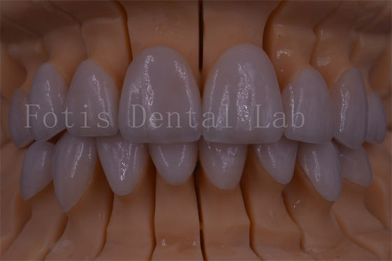 FDA/ISO/CE Certificato corone digitale denti corone artificiale di qualsiasi dimensione