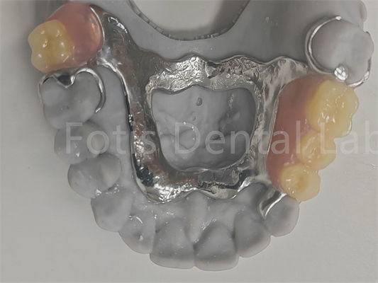 FDA Dente parziale rimovibile facile da pulire compatibile con i denti naturali