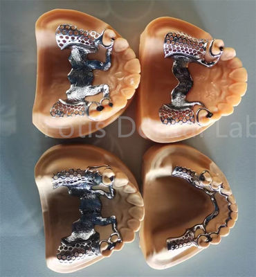 Protesi parziale flessibile e rimovibile con stabilità duratura e comfort regolabile