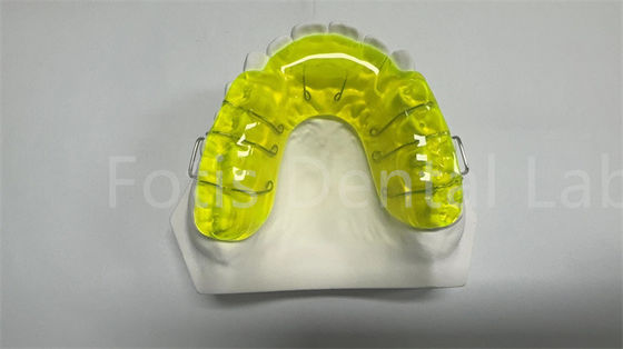 Apparecchio di spaziatura ortodontica conveniente
