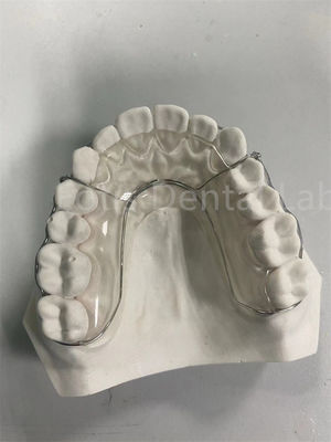 Soluzione di ritenzione dei denti resistente e versatile