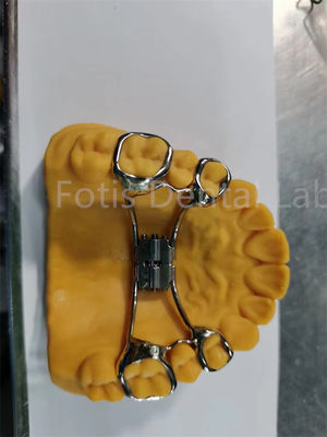 Dispositivo igienico ortodontico facile da pulire Ritenitore dentale Disegno regolabile