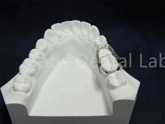 Soluzione ortodontica conveniente Mantenimento semplice
