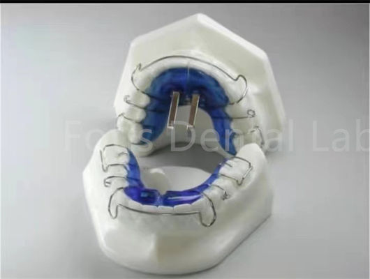 Trattamento ortodontico di contenitore di espansione per l' allineamento preciso dei denti