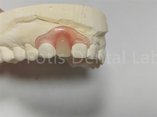 Parziali dentali flessibili rosa / trasparente Valspar regolazione facile