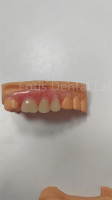 Durabile TCS Valplast parziale flessibile Protesi flessibili resistenti alle macchie